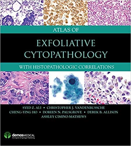 Atlas of Exfoliative Cytopathology: With Histopathologic Correlations - eBook