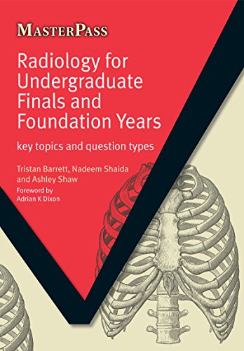 Radiology for Undergraduate Finals and Foundation Years: Key Topics and Question Types (MasterPass) - eBook