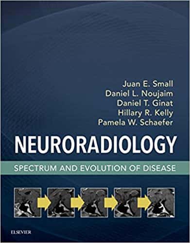 Neuroradiology: Spectrum and Evolution of Disease - eBook