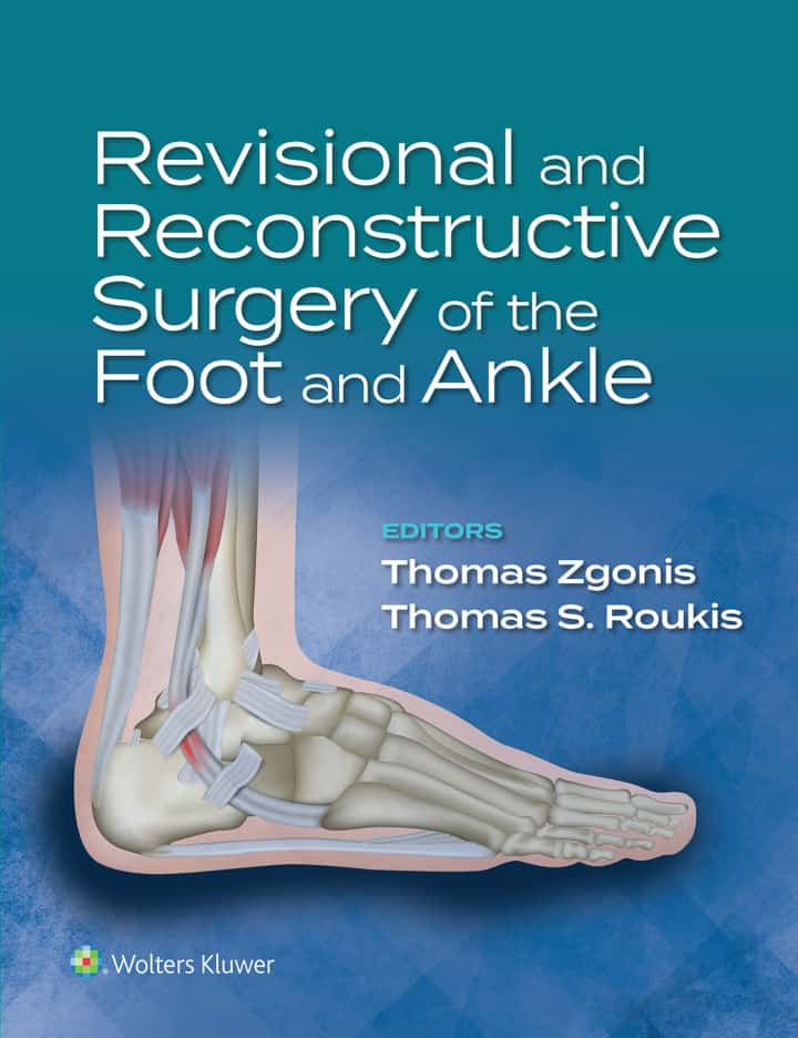 Revisional and Reconstructive Surgery of the Foot and Ankle 1st Edition