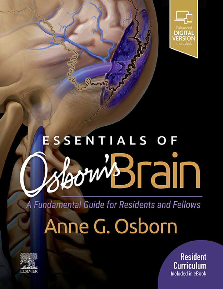 Essentials of Osborn's Brain - eBook